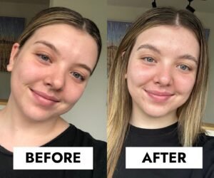 Celebrity Transformations: The Ever-Evolving Faces of Fame